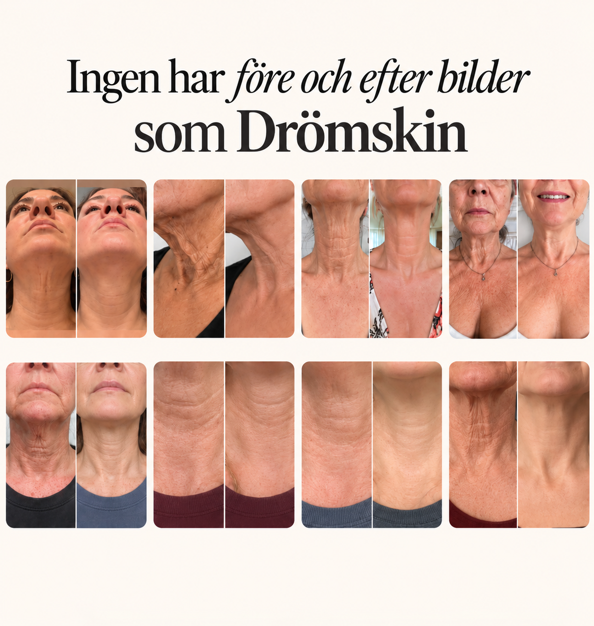 Tighten & Lift Halskräm
